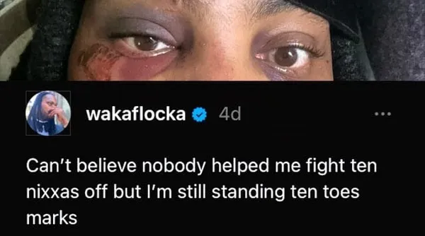 Pretending To Get Jumped Is Crazy